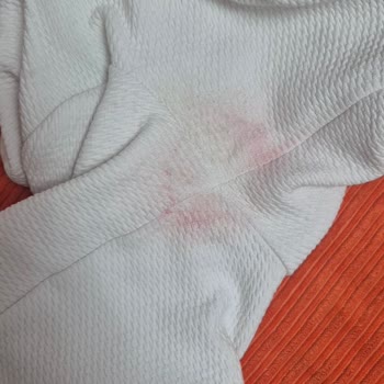 Us Polo Marka Montunun Renk Değişimi Ve Boya Sorunu, Para İadesi Talebi