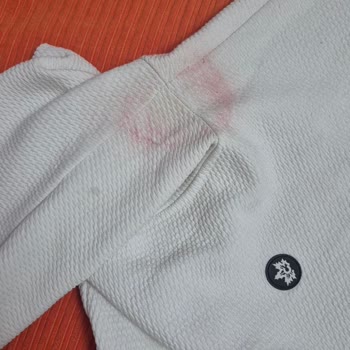 Us Polo Marka Montunun Renk Değişimi Ve Boya Sorunu, Para İadesi Talebi