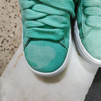 Turkishcare Ürünündeki Yanıltıcı Etiket Nedeniyle Adidas Ayakkabım Bozuldu