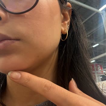 Hydra Vegetal 48h Gel Cream Yüzde Soyulma Sorunu Ve İade Değişim Talebi