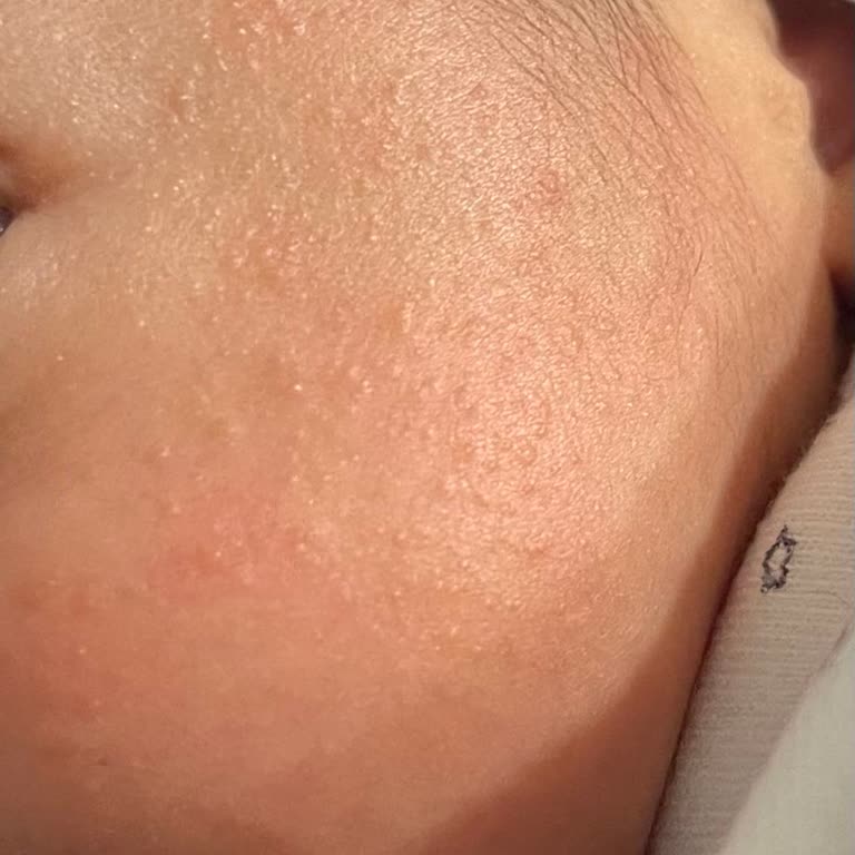 Golden Goat 1 Devam Sütü’nde Kabızlık Ve Cilt Sorunları Nedeniyle İade Talebi