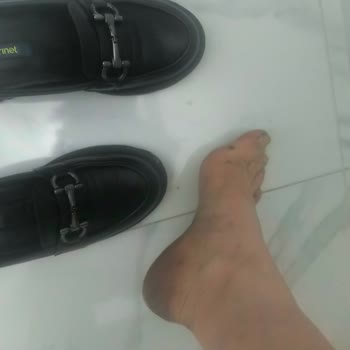 Ayak Sağlığına Verdiği Zarar Ve Rahatsızlık Nedeniyle Tüm Ayakkabılar İçin İade Talebi