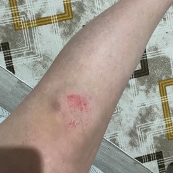 Paşa Camii Önündeki Paspas Nedeniyle Düşen Vatandaşa Güvenlik Düzenlemesi Talebi