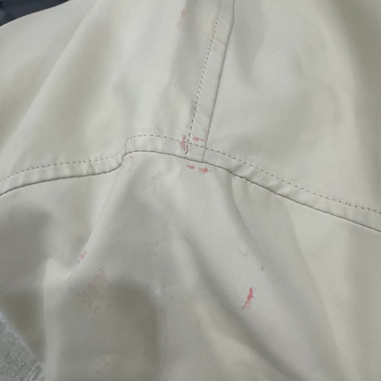 Kolayca Lekelenen Yağmurluk İade Talebi