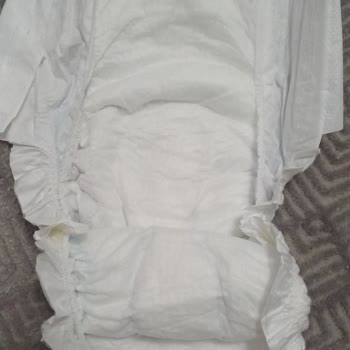 Molfix 5 Numaralı Bebek Bezinde Paket Ve Kalite Sorunu