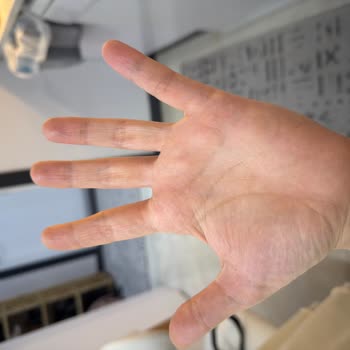 Dove Caring Sıvı Sabunun Cilt Kuruluğu Ve Yanıltıcı Nemlendirme İddiası