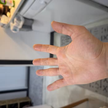 Dove Caring Sıvı Sabunun Cilt Kuruluğu Ve Yanıltıcı Nemlendirme İddiası