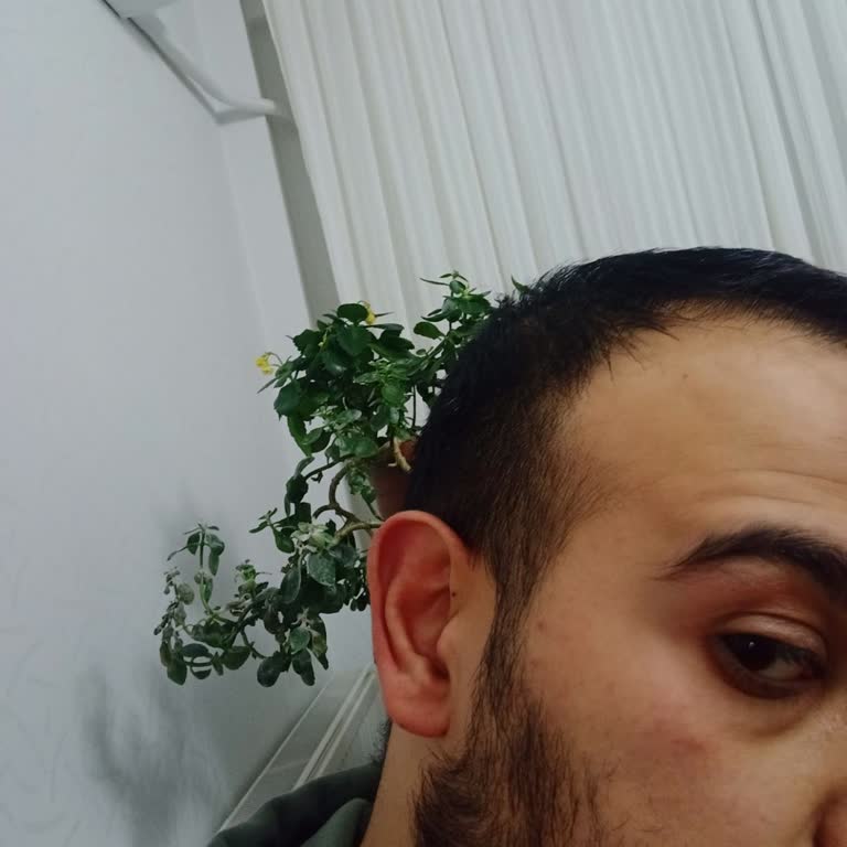 Siveno Beyazlatıcı Yüz Kremi Ciltte Şiddetli Kızarıklığa Ve Kalıcı Hasara Neden Oluyor