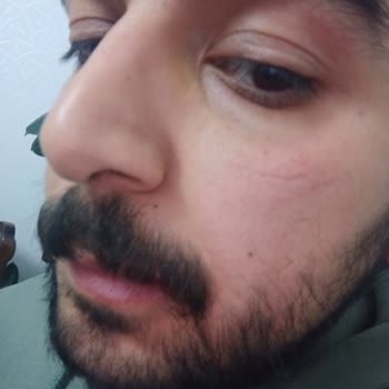 Skin Sensual Ürün Yüzümde Yanma Yaptı