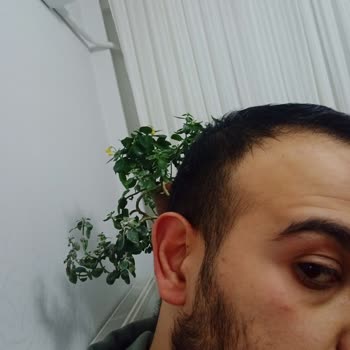 Skin Sensual Vitamin C Gibi Pazarlanan Ürün Cildimi Yakarak Kalıcı Hasara Yol Açtı