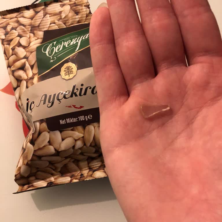 Cam Parçası İçeren Ayçekirdeği Ürünü Sağlık Riski Ve Tazminat Talebi