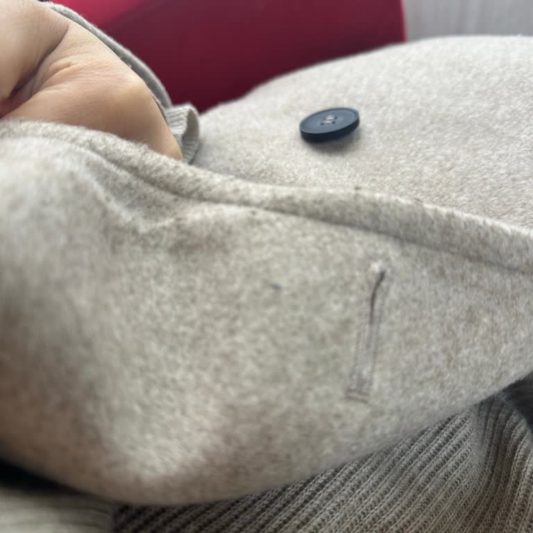 Zara Kadın Kabanı Kısa Sürede Tüylendi Ve Kullanılamaz Hale Geldi