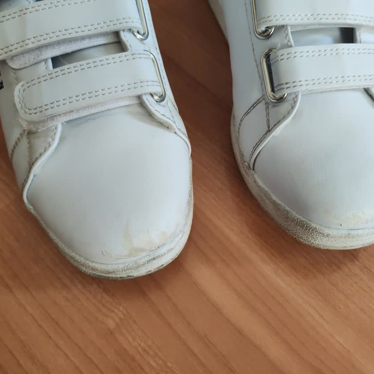 Sadece İki Kez Kullanılan Ayakkabıda Deri Soyulması Ve Mağaza Tarafından Kullanıcı Hatası İddiası