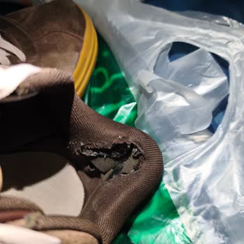 Deichmann'da Satın Alınan Adidas Ayakkabıda İç Topuk Yırtılmaları Ve Kullanıcı Hatası İddiası