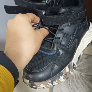 Vicco Ortopedik Bot İçindeki Sert Parça Çocuğun Baş Parmağını Yaraladı