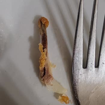 Keskinoğlu Çıtır Bonfile Ürününün İçinde Kemik Parçası Bulundu