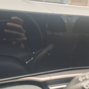 Garanti Kapsamı Dışındaki Çizik Ve Servisin Çözüm Sürecindeki Tutarsızlık