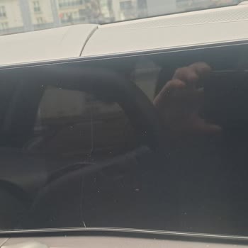 Garanti Kapsamı Dışındaki Çizik Ve Servisin Çözüm Sürecindeki Tutarsızlık