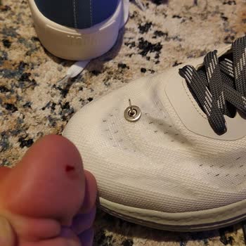 Ayakkabıda Bırakılan İğne Baş Parmakta Ağır Yaralanma Ve Sağlık Riski