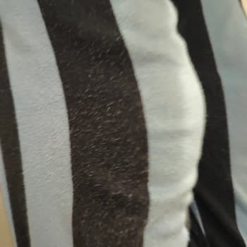 Penti Çocuk Pijamasının Kısa Sürede Tüylenmesi Ve Deforme Olması