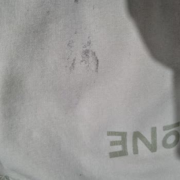 Bershka Bomber Deri Çeketin Renk Sızması Ve Sağlık Riski