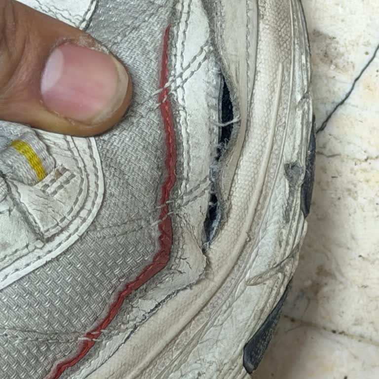 Skechers Ayakkabısında Üretim Hatası Ve Garanti Reddi