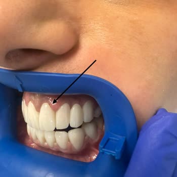 Dt. Oğuz Yıldız Gülüş Tasarımı Hayal Kırıklığı İle Sonuçlandı!