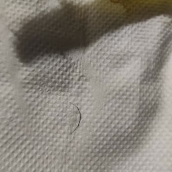 Krema İçinde Kıl Bulunması Güveni Sarsıyor Ve İade Talebi