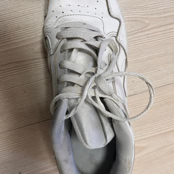 Ayakkabının Yanları Açıldı, Topuk Deforme Oldu, Kullanıcı Hatası Olarak Reddedildi