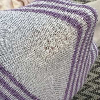 LCW Kız Çocuk Kıyafetlerinde Yırtılma Sorunu Ve İade Talebi