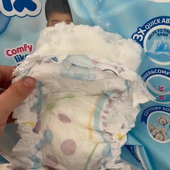 Molfix Bebek Bezinde Yırtık Ve Doldurucu Sızıntı, Kargo Teslimatı Zorluğu