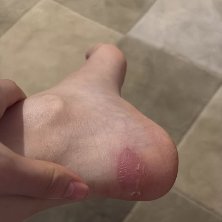 Derimod Torium Çadırın Ayağımı Vurması Ve Desteksiz Değişim Reddi