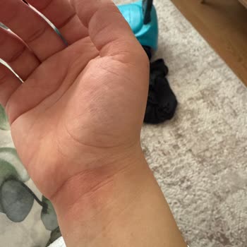 Pirantech Buharlı Temizlik Makinesinde Güvenlik Sorunu Ve Yanık Şikayeti