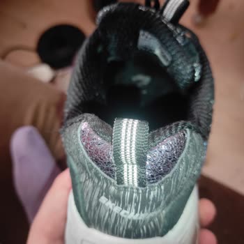 Skechers Ayakkabısının Kısa Sürede Delinmesi Ve Kullanıcı Hatası Reddi