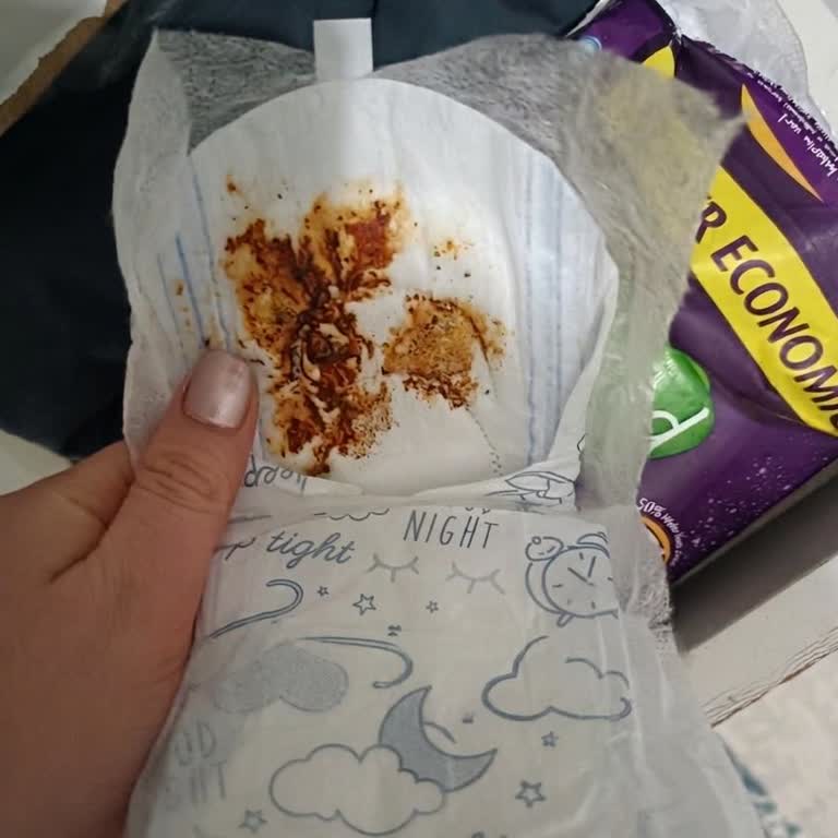 Molped Pedlerde Hijyen Sorunu Ve Kahverengi Lekeler