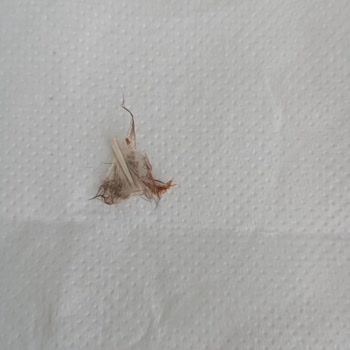 File Market Cam Kavanozda Tavuk Tüyü Ve Hijyen Dışı Kalıntı