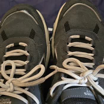 Skechers Ayakkabının Kısa Sürede Açılması Ve Kalite Şikayeti