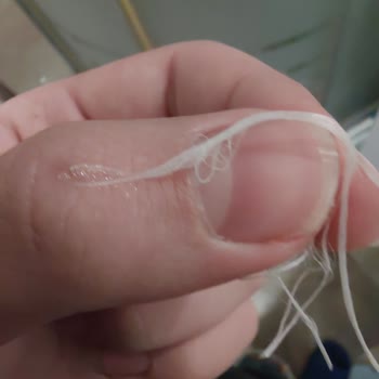 Prokudent Diş İpinde Parçalanma Ve Dolgu Riski