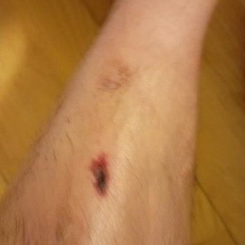 Batum Bilyoner Casino’da Haksız Gözaltı Ve Cüzdan Çalınması Olayı