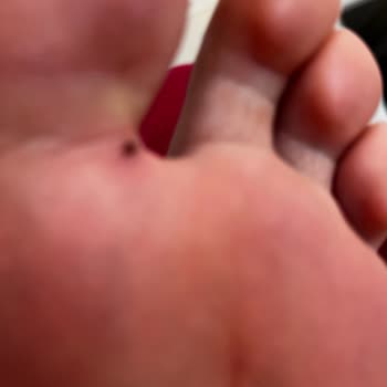 Kirpik Liftinginde Kırılma, Pedikürde Yaralanma Ve Tam İade İsteği