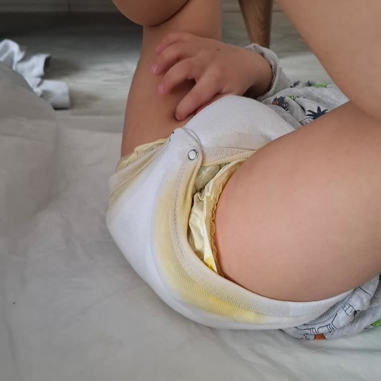 Molfix Premium Bebek Bezlerinde Sızdırma Ve Hatalı Ürün, Destek Erişilemiyor