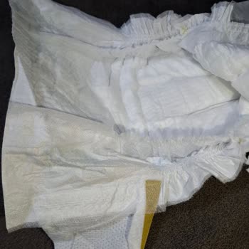 Molfix Premium Bebek Bezlerinde Sızdırma Ve Hatalı Ürün, Destek Erişilemiyor