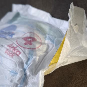 Molfix Premium Bebek Bezlerinde Sızdırma Ve Hatalı Ürün, Destek Erişilemiyor