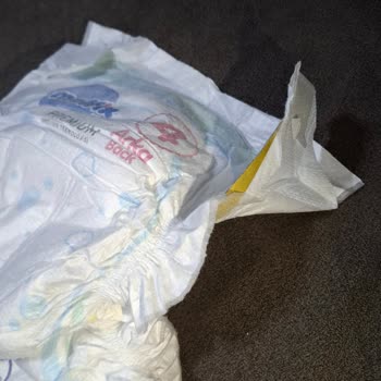 Molfix Premium Bebek Bezlerinde Sızdırma Ve Hatalı Ürün, Destek Erişilemiyor