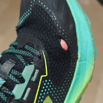 2 Yıllık Garantili Çocuk Ayakkabısı 6 Ayda Yırtıldı Ve Garanti Kabul Edilmedi