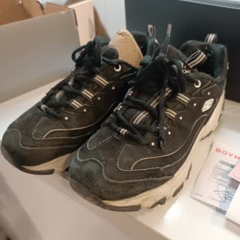 Skechers Ayakkabım Kısa Sürede Deforme Oldu, Değişim Talebim