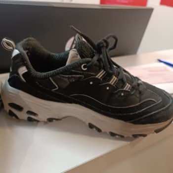 Skechers Ayakkabım Kısa Sürede Deforme Oldu, Değişim Talebim
