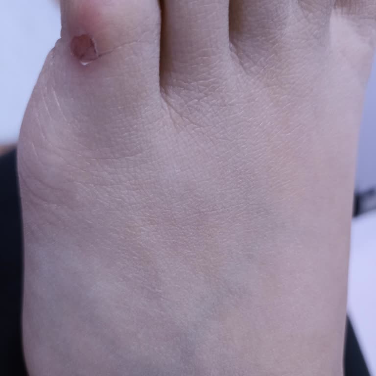 Boyner Mağazasında Reebok Ayakkabının Rahatsız Etmesi Ve Değişim Reddi