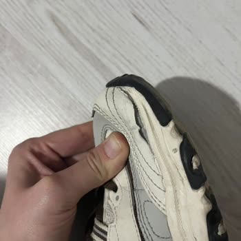 Garanti Kapsamındaki Skechers Ayakkabının Dış Kaplama Kalkması Ve Talebin Reddedilmesi