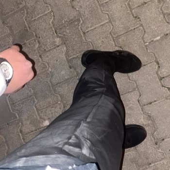 Hop Scooter Ani Yavaşlama Nedeniyle Düşüş Ve Tazminat Talebi